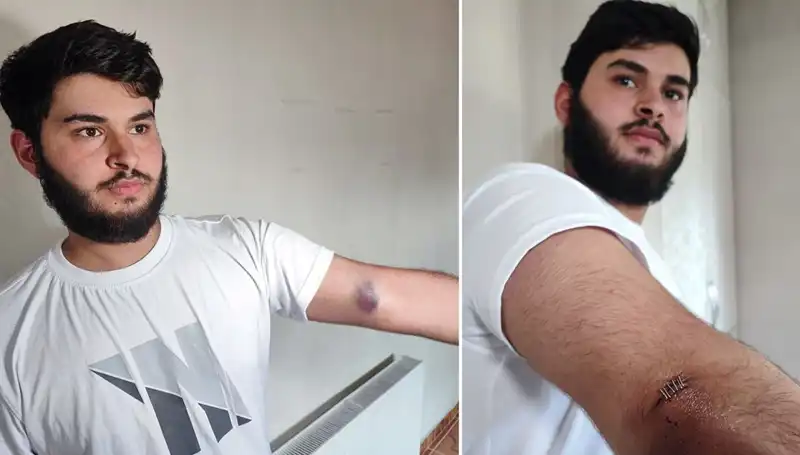 Bahçeye Kaçan Top, Mahallede İnanılmaz Olaylara Neden Oldu!